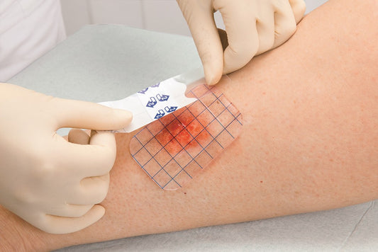 Alegerea pansamentului pentru tratament escare